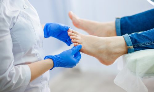 Podiatry doctor examines the foot